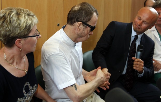 Pacjent po przeszczepie twarzy